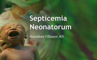 Septicemia
Neonatorum
Hannilore Villamor, RN
 