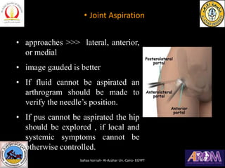 • Joint Aspiration
• approaches >>> lateral, anterior,
or medial
• image gauded is better
• If fluid cannot be aspirated a...