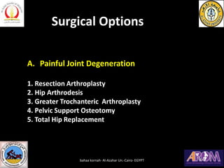 A. Painful Joint Degeneration
1. Resection Arthroplasty
2. Hip Arthrodesis
3. Greater Trochanteric Arthroplasty
4. Pelvic ...