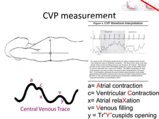 CVP measurement




         a= Atrial contraction
         c= Ventricular Contraction
         x= Atrial relaXation
         v= Venous filling
         y = Tr”Y”cuspids opening
 