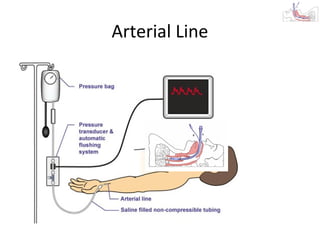 Arterial Line
 
