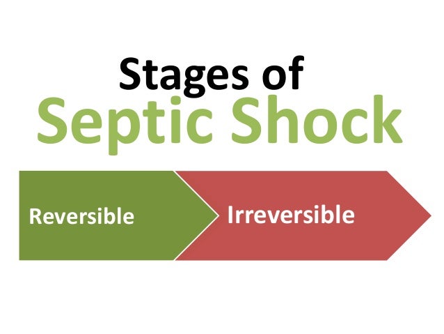 septic system shock treatment reviews