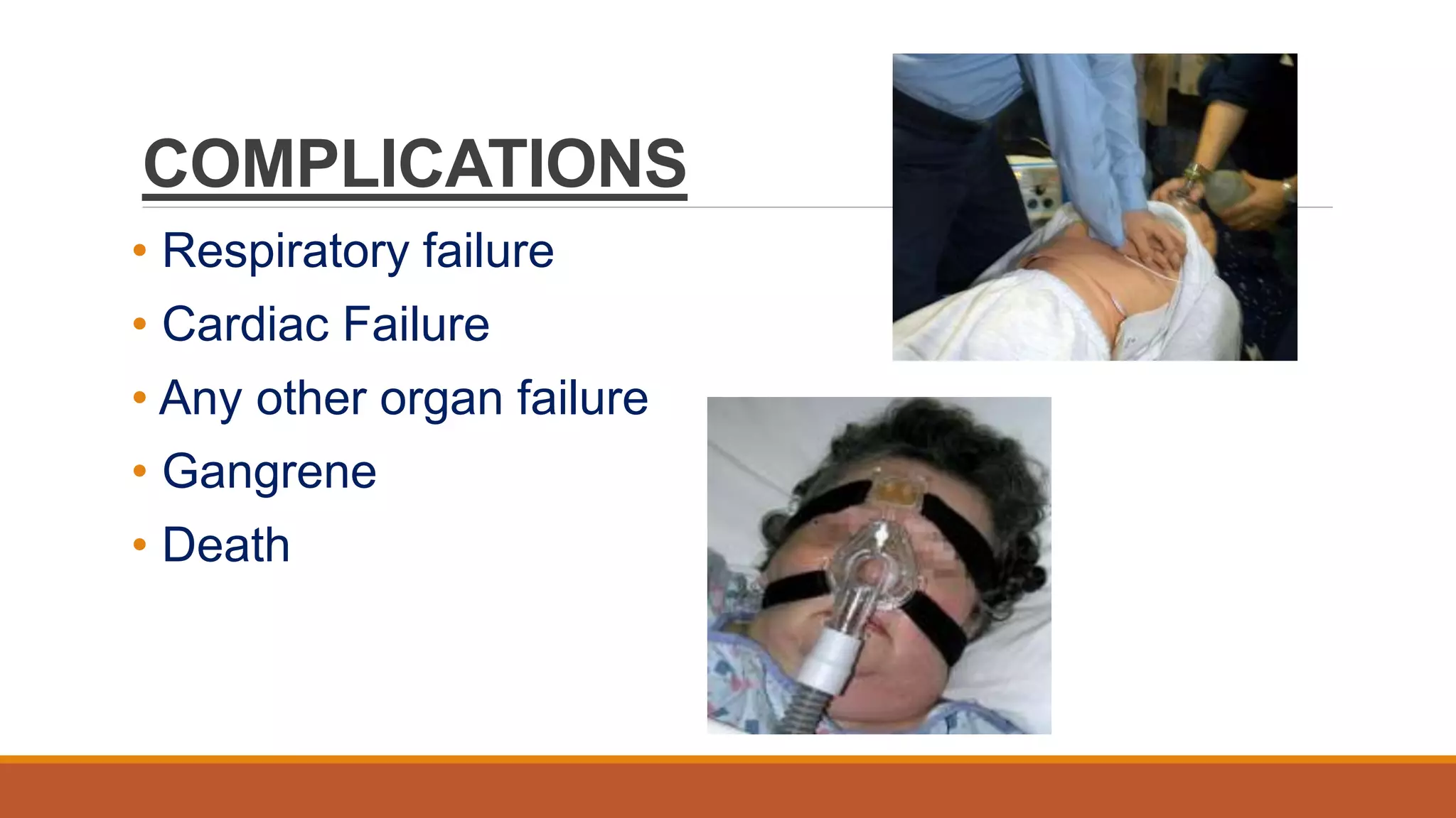 Septic shock PPT