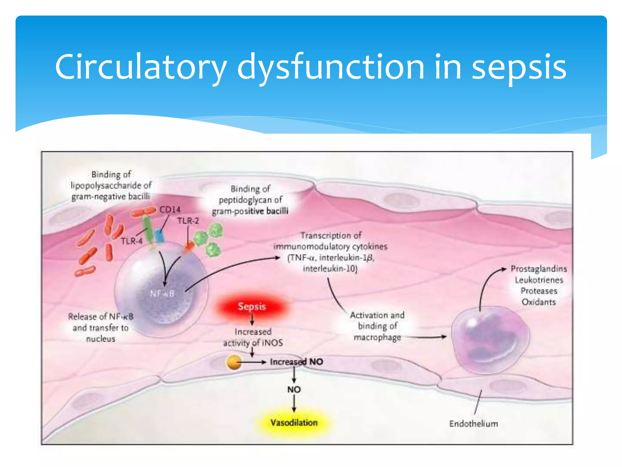 Sepsis Shock Example Septic shock.pptx