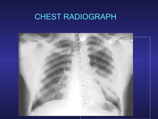 CHEST RADIOGRAPH 