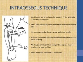 INTRAOSSEOUS TECHNIQUE
• Used in poor peripheral vascular access- 2 IV line attempts
unsuccessful- choose IO
• Sites: Tibial tuberosity, lower end of femur and lower end of
tibia
• Intraosseous needle /bone marrow aspiration needle
• Position: Fluid should infuse easily without evidence of soft-
tissue swelling
• Most successful in children younger than age six- may be
employed in older children
• Fluids, inotropes, antibiotics, transfusions
 