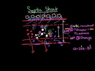 Septic shock presentation | PPTX
