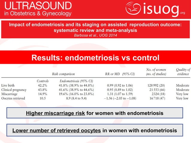 UOG Journal Club: Impact of endometriosis and its staging on assisted ...