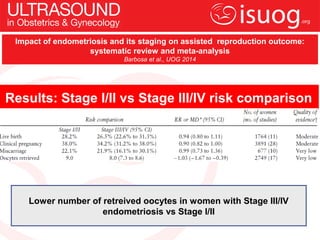 UOG Journal Club: Impact of endometriosis and its staging on assisted ...