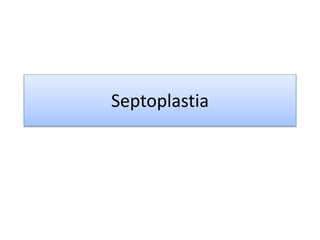 Septoplastia
 