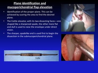 Plane identification and
mucoperichondrial flap elevation
• Identification of the proper plane. This can be
achieved by scoring the area to find the desired
plane.
• The Cottle elevator, with its two dissecting faces—one
shaped like a sharpened spade, the other more flat
and dull is used to raise the envelope under direct
vision.
• The sharper, spadelike end is used first to begin the
dissection in the submucoperichondrial plane.
 
