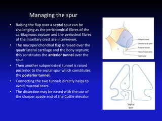 Managing the spur
• Raising the flap over a septal spur can be
challenging as the perichondrial fibres of the
cartilaginous septum and the periosteal fibres
of the maxillary crest are interwoven.
• The mucoperichondrial flap is raised over the
quadrilateral cartilage and the bony septum;
this constitutes the anterior tunnel over the
spur.
• Then another subperiosteal tunnel is raised
posterior to the septal spur which constitutes
the posterior tunnel.
• Connecting the two tunnels directly helps to
avoid mucosal tears.
• The dissection may be eased with the use of
the sharper spade end of the Cottle elevator
 