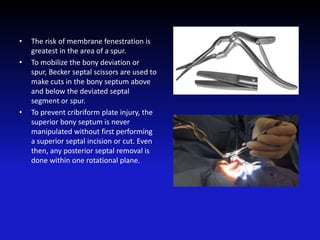 • The risk of membrane fenestration is
greatest in the area of a spur.
• To mobilize the bony deviation or
spur, Becker septal scissors are used to
make cuts in the bony septum above
and below the deviated septal
segment or spur.
• To prevent cribriform plate injury, the
superior bony septum is never
manipulated without first performing
a superior septal incision or cut. Even
then, any posterior septal removal is
done within one rotational plane.
 