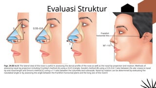 Septorhinoplasty anatomy and physiology.pptx