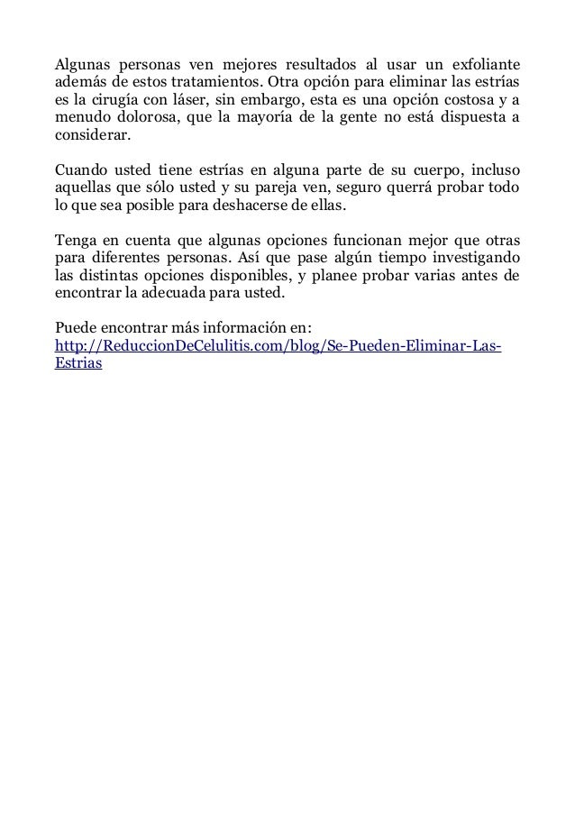 Es verdad que van a desaparecer las opciones binarias