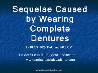 Sequelae Caused
by Wearing
Complete
Dentures
INDIAN DENTAL ACADEMY
Leader in continuing dental education
www.indiandentalacademy.com
www.indiandentalacademy.comwww.indiandentalacademy.com
 