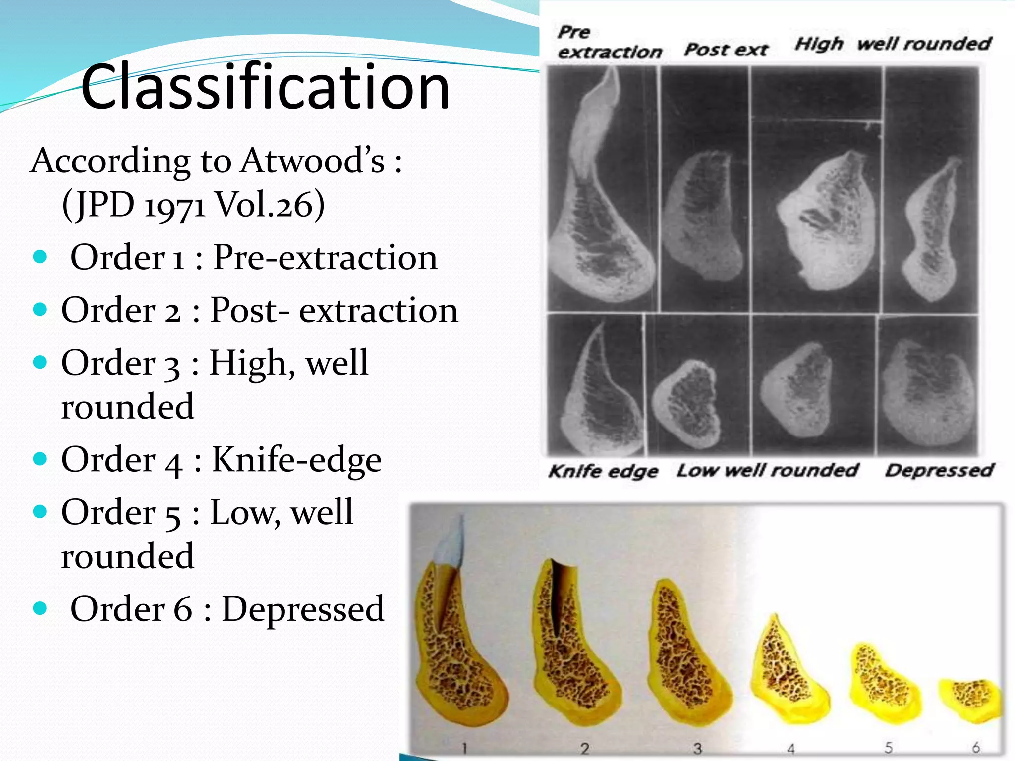 Sequelae of wearing complete denture | PPTX