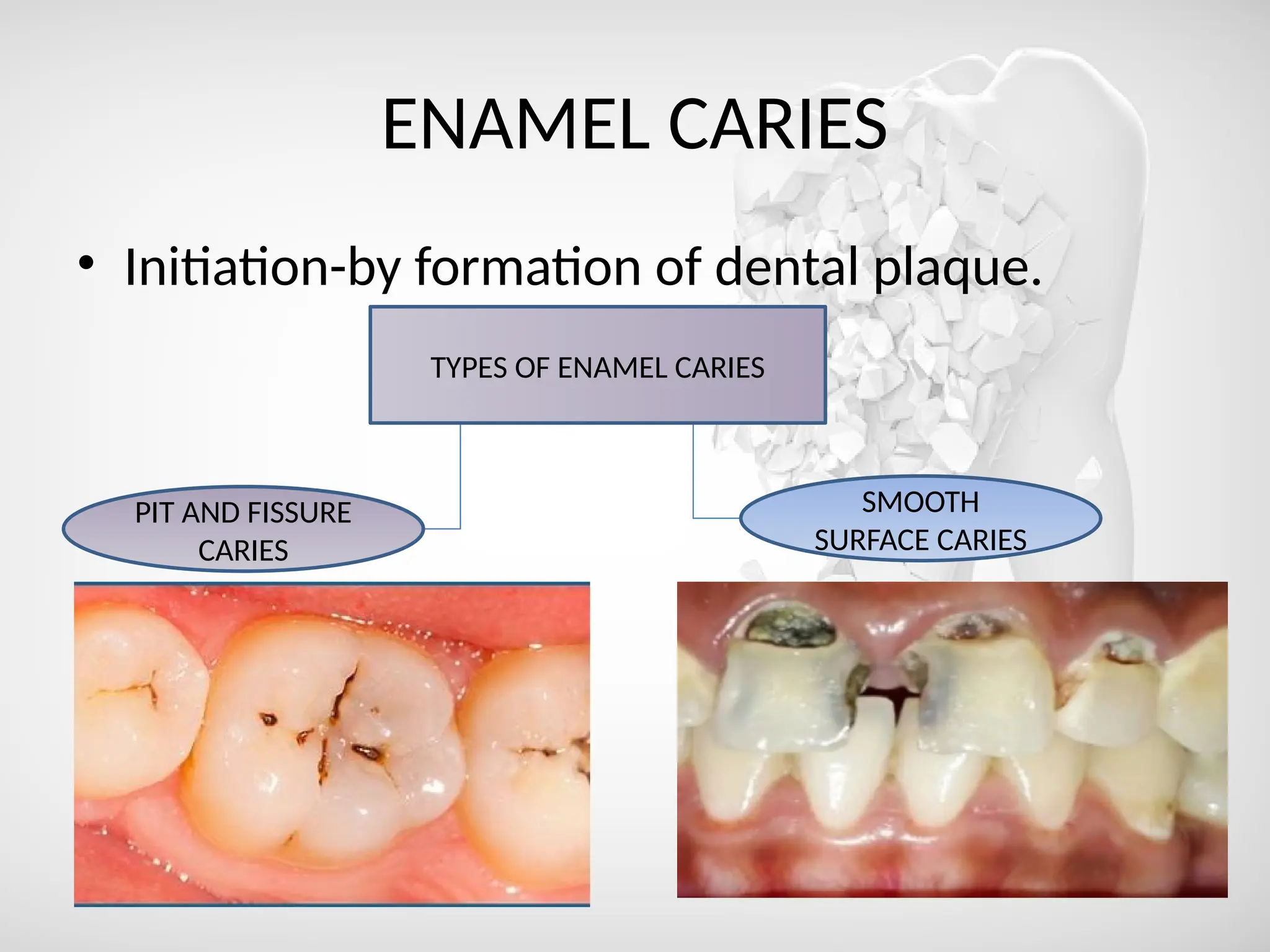 ENAMEL CARIES
• Initiation-by formation of dental plaque.
TYPES OF ENAMEL CARIES
SMOOTH
SURFACE CARIES
PIT AND FISSURE
CARIES
 