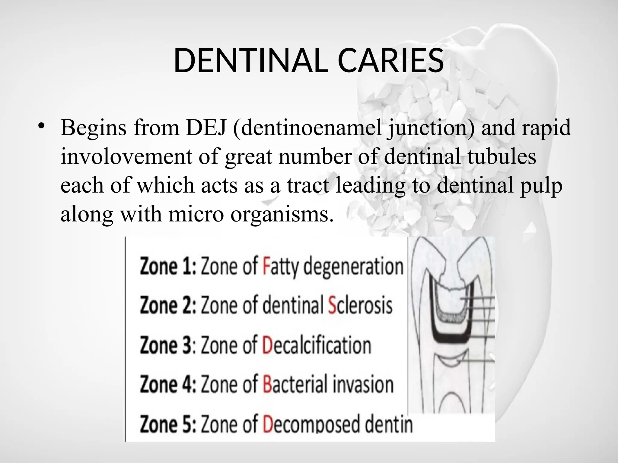 DENTINAL CARIES
• Begins from DEJ (dentinoenamel junction) and rapid
involovement of great number of dentinal tubules
each of which acts as a tract leading to dentinal pulp
along with micro organisms.
 