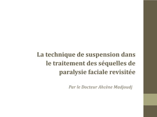 La technique de suspension dans
le traitement des séquelles de
paralysie faciale revisitée
Par le Docteur Ahcène Madjoudj

 