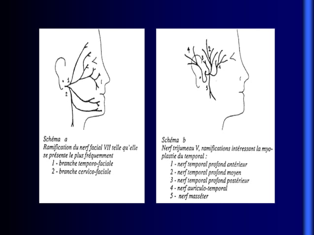 Meobius Forma Sequencia de Moebius | PPT
