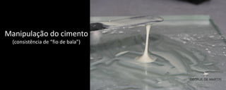 Manipulação do cimento
(consistência de “fio de bala”)

GEORJE DE MARTIN

 