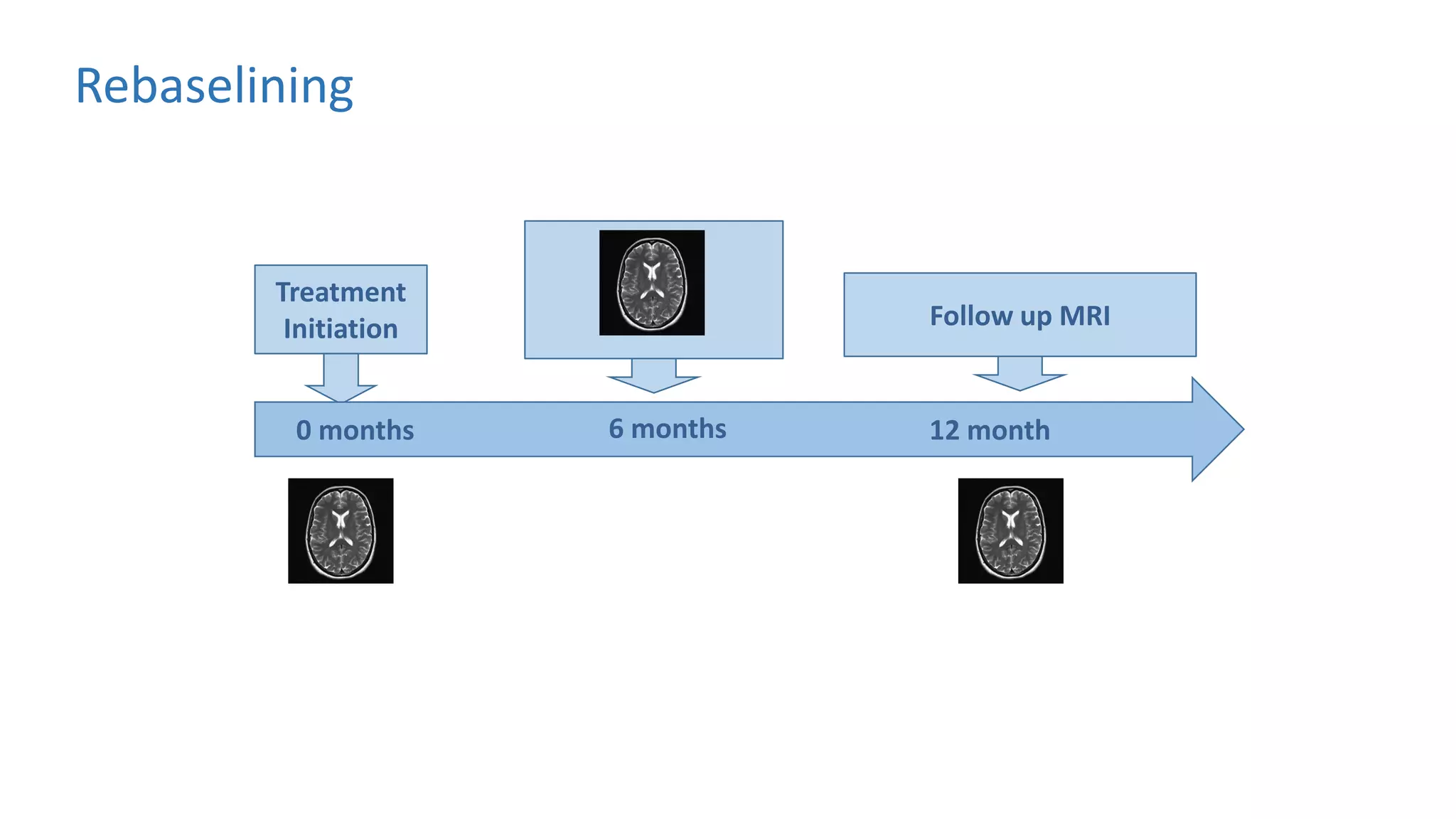 Treatment
Initiation Follow up MRI
0 months 6 months 12 month
Rebaselining
 