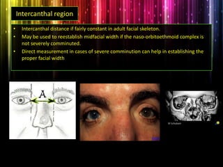 Intercanthal region
• Intercanthal distance if fairly constant in adult facial skeleton.
• May be used to reestablish midfacial width if the naso-orbitoethmoid complex is
not severely comminuted.
• Direct measurement in cases of severe comminution can help in establishing the
proper facial width
 