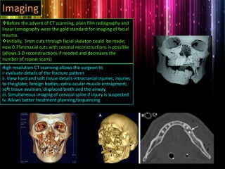 Before the advent of CT scanning, plain film radiography and
linear tomography were the gold standard for imaging of facial
trauma.
Initially, 5mm cuts through facial skeleton could be made;
now 0.75mmaxial cuts with coronal reconstructions is possible
(allows 3-D reconstructions if needed and decreases the
number of repeat scans)
Imaging
High resolution CT scanning allows the surgeon to
i. evaluate details of the fracture pattern
ii. View hard and soft tissue details-intracranial injuries; injuries
to the globe; foreign bodies; extra-ocular muscle entrapment;
soft tissue avulsion; displaced teeth and the airway.
iii. Simultaneous imaging of cervical spine if injury is suspected.
Iv. Allows better treatment planning/sequencing
 