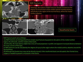 NOE fractures
Radiologic description of NOE fractures should comment on the
degree of comminution of the medial vertical maxillary buttress,
specifically in the region of the lacrimal fossa, where the medial
canthus attaches.
Nasofrontal ducts.
NOE fracture pearls are as follows:
(a) NOE fractures are distinguished from simple nasal fractures by posterior disruption of the medial canthal
region, the ethmoids, and the medial orbital walls.
(b) Clinically, the most obvious deformity is loss of nasal projection in profile and apparent increased distance between
the inner corners of the eyes.
(c) NOE fractures can be classified by the degree of injury to the region where the medial canthus attaches around the
lacrimal fossa.
(d) Although the frontal sinus may not be directly injured, if the nasofrontal ducts are disrupted, then frontal sinus
surgery is needed to prevent a mucocele in the future.
 