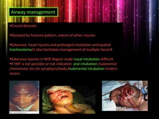 Crucial decision
Dictated by fracture pattern, extent of other injuries
Extensive head injuries and prolonged intubation anticipated-
tracheostomy(it also facilitates management of multiple facial #.
Extensive injuries in NOE Region make nasal intubation difficult
If IMF is not possible or not indicated- oral intubation /submental
/retromolar (in c/o symphysis/body #submental intubation hinders
access
Airway management
 