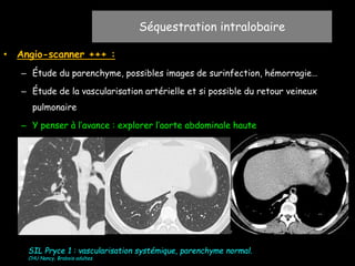 • Angio-scanner +++ :
– Étude du parenchyme, possibles images de surinfection, hémorragie…
– Étude de la vascularisation artérielle et si possible du retour veineux
pulmonaire
– Y penser à l’avance : explorer l’aorte abdominale haute
Séquestration intralobaire
SIL Pryce 1 : vascularisation systémique, parenchyme normal.
CHU Nancy, Brabois adultes
 