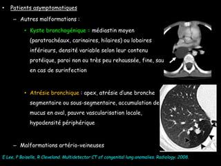 • Patients asymptomatiques
– Autres malformations :
• Kyste bronchogénique = médiastin moyen
(paratrachéaux, carinaires, hilaires) ou lobaires
inférieurs, densité variable selon leur contenu
protéique, paroi non ou très peu rehaussée, fine, sauf
en cas de surinfection
• Atrésie bronchique : apex, atrésie d’une bronche
segmentaire ou sous-segmentaire, accumulation de
mucus en aval, pauvre vascularisation locale,
hypodensité périphérique
– Malformations artério-veineuses
E Lee, P Boiselle, R Cleveland. Multidetector CT of congenital lung anomalies. Radiology. 2008.
 