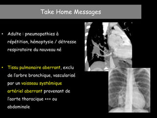 • Adulte : pneumopathies à
répétition, hémoptysie / détresse
respiratoire du nouveau né
• Tissu pulmonaire aberrant, exclu
de l’arbre bronchique, vascularisé
par un vaisseau systémique
artériel aberrant provenant de
l’aorte thoracique +++ ou
abdominale
Take Home Messages
 