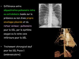 • Différence entre
séquestration pulmonaire intra
ou extralobaire basée sur la
présence ou non d’une propre
enveloppe pleurale et du
retour veineux : pulmonaire
pour la SIL, par le système
azygos ou la veine cave
inférieure pour la SEL
• Traitement chirurgical sauf
pour les SIL Pryce 1
(endovasculaire)
 