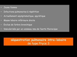 • Jeune femme
• Infections pulmonaires à répétition
• Actuellement asymptomatique, apyrétique
• Masse lobaire inférieure droite
• Exclue de l’arbre bronchique
• Vascularisée par un vaisseau issu de l’aorte thoracique
séquestration pulmonaire intra-lobaire
de type Pryce 3
 