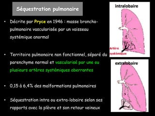 Séquestration pulmonaire
• Décrite par Pryce en 1946 : masse broncho-
pulmonaire vascularisée par un vaisseau
systémique anormal
• Territoire pulmonaire non fonctionnel, séparé du
parenchyme normal et vascularisé par une ou
plusieurs artères systémiques aberrantes
• 0,15 à 6,4% des malformations pulmonaires
• Séquestration intra ou extra-lobaire selon ses
rapports avec la plèvre et son retour veineux
 