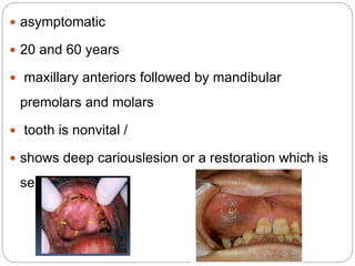 Pulpitis Skin sequle of pulpitis.pptx