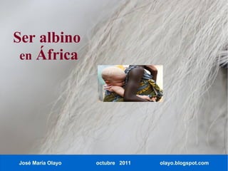 Ser albino
 en África




José María Olayo   octubre 2011   olayo.blogspot.com
 
