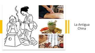 La Antigua
China
 