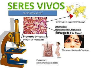 MICROORGANISMOS Protozoo  ( Trypanosoma cruzi ) es un Protoctista Enfermedad: Tripanosomiasis americana  ( enfermedad  de ...