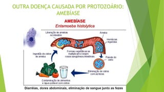 OUTRA DOENÇA CAUSADA POR PROTOZOÁRIO:
AMEBÍASE
 