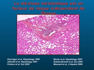 La sté atose mé tabolique est un
     facteur de risque indé pendant de
                   fibrose




Hourrigan et al, Hepatology 1999   Monto et al, Hepatology 2002
Adinolfi et al, Hepatology 2001    Rubbia-Brandt et al, Gut 2004
Fartoux et al, Gut 2005            Massard et al, J Hepatol 2006
 