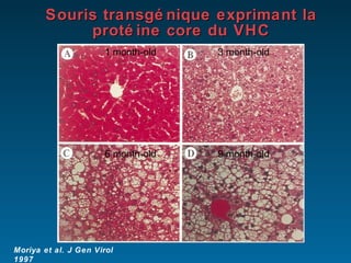 Souris transgénique exprimant la protéine core du VHC Moriya et al. J Gen Virol 1997 1 month-old 3 month-old 6 month-old 9 month-old 