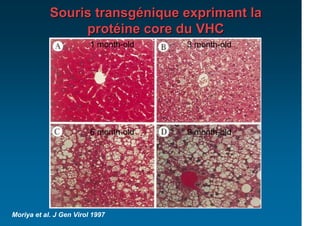 Souris transgénique exprimant la
                 protéine core du VHC
                         1 month-old   3 month-old




                         6 month-old   9 month-old




Moriya et al. J Gen Virol 1997
 