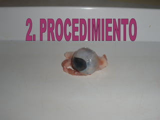 2. PROCEDIMIENTO 
