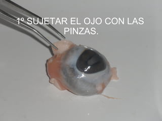 1º SUJETAR EL OJO CON LAS  PINZAS. 