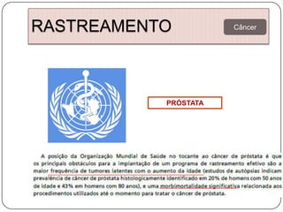 RASTREAMENTO          Câncer




           PRÓSTATA
 
