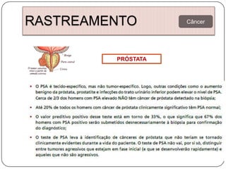 RASTREAMENTO        Câncer




         PRÓSTATA
 