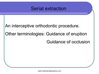Serial extraction
An interceptive orthodontic procedure.
Other terminologies: Guidance of eruption
Guidance of occlusion
www.indiandentalacademy.com
 